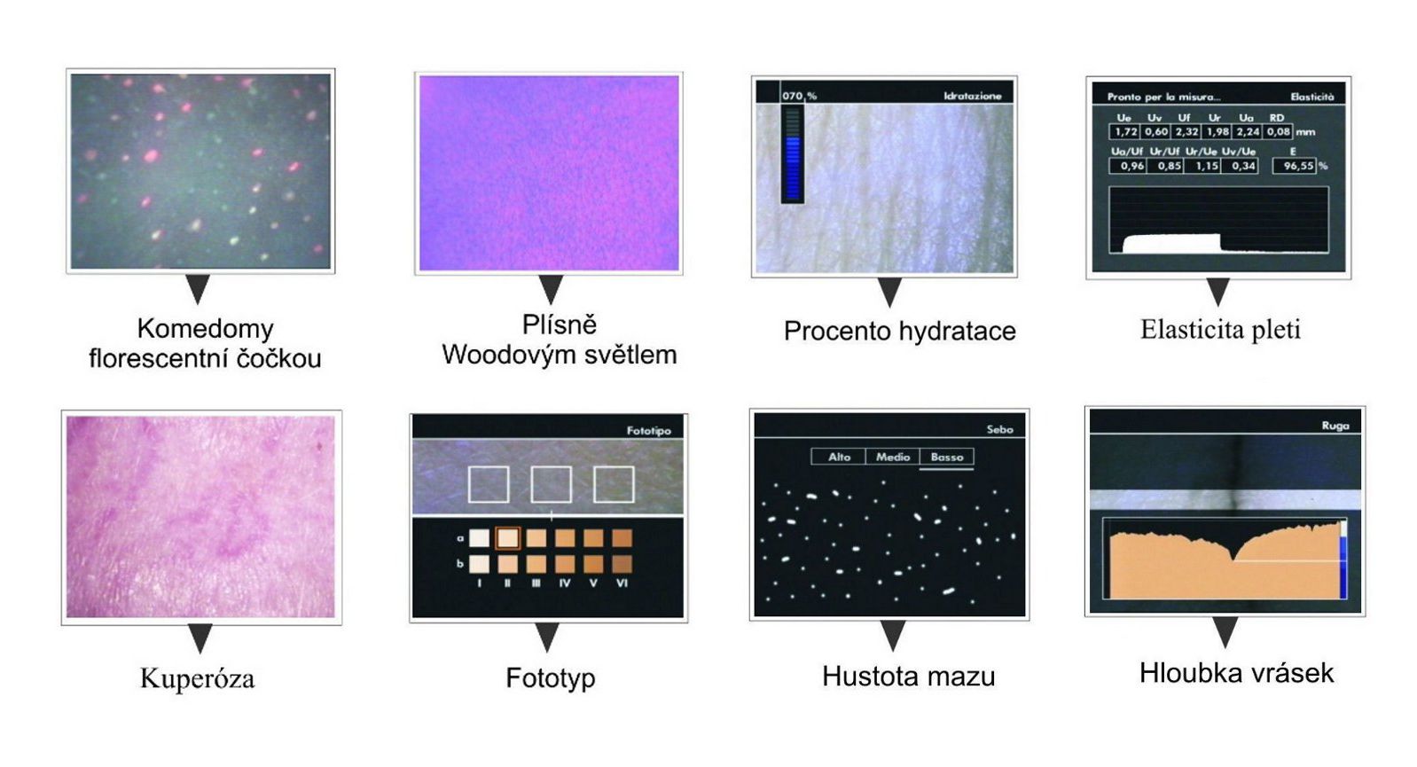 microkamera funkce