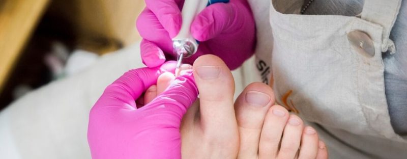 Suchá přístrojová pedikúra centru Brna u SlimFOX
